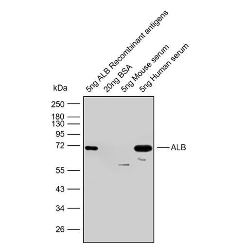 Anti-ALB Monoclonal Antibody