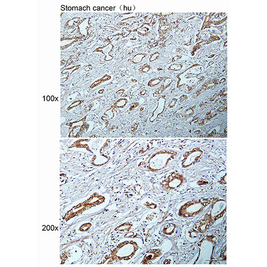 Anti-AAK1 Polyclonal Antibody