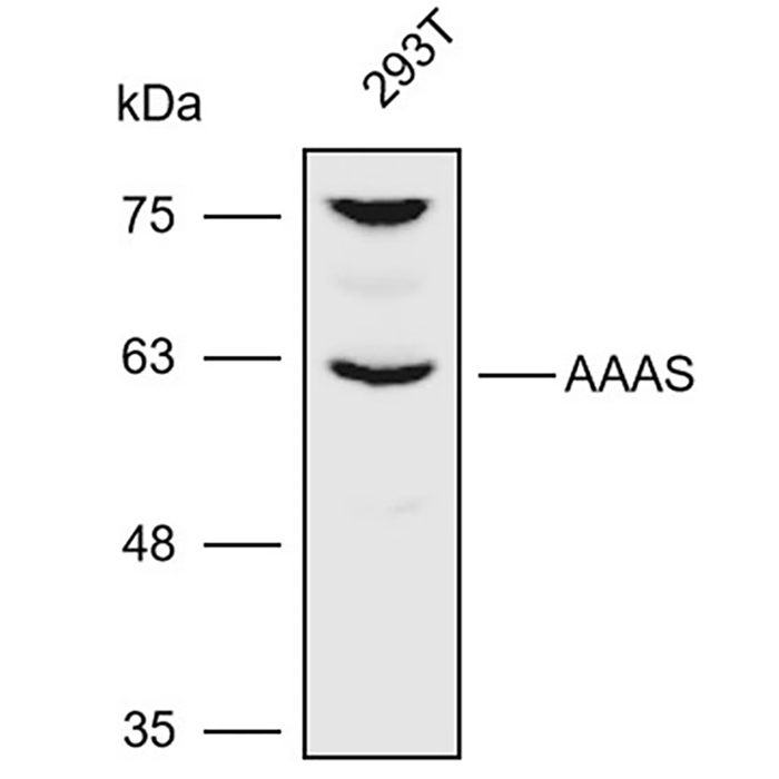 Anti-AAAS Polyclonal Antibody