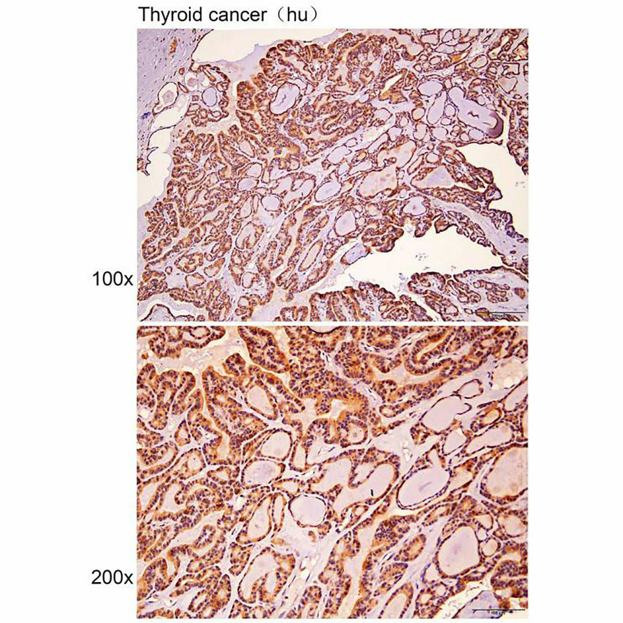 Anti-AAAS Polyclonal Antibody Figure 2