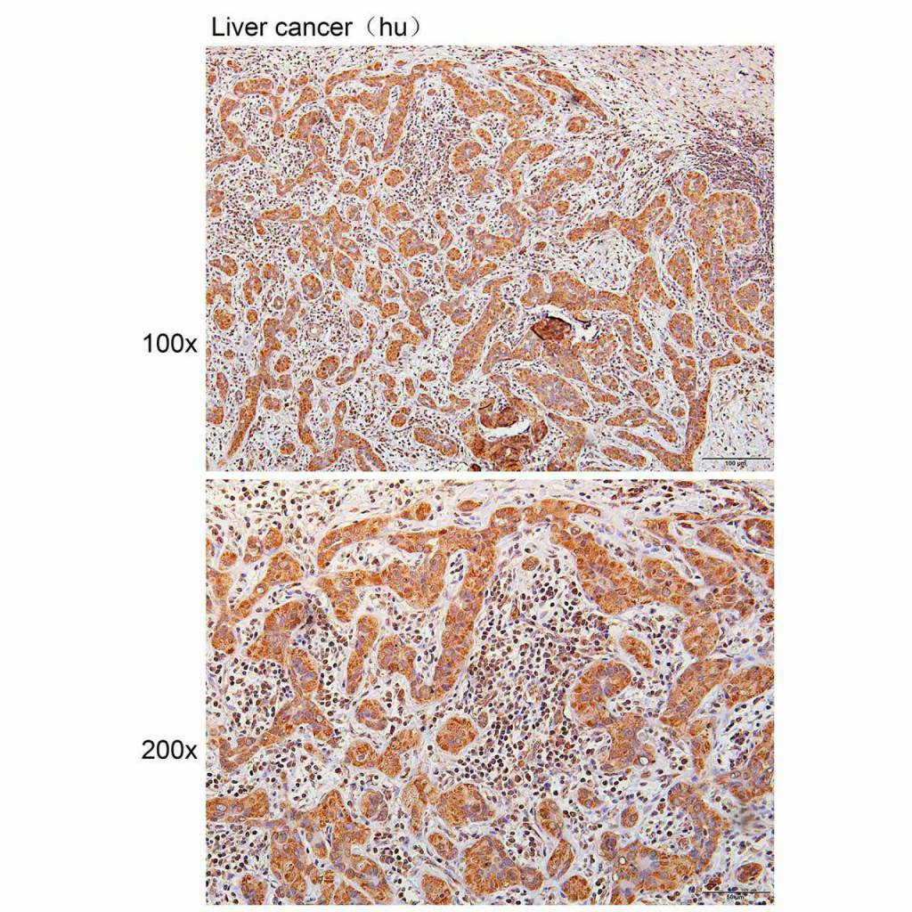 Anti-A4GNT Polyclonal Antibody