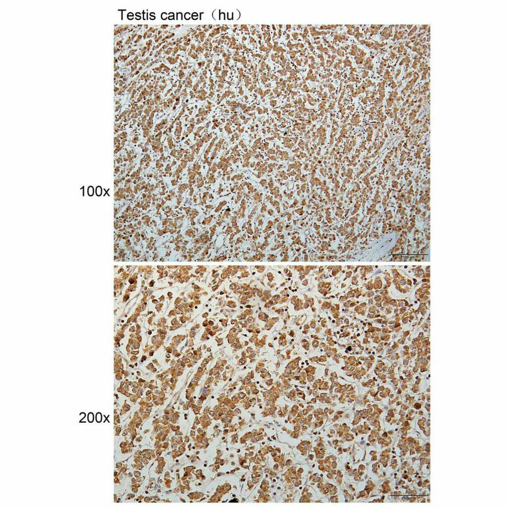 Anti-A4GNT Polyclonal Antibody Figure 2
