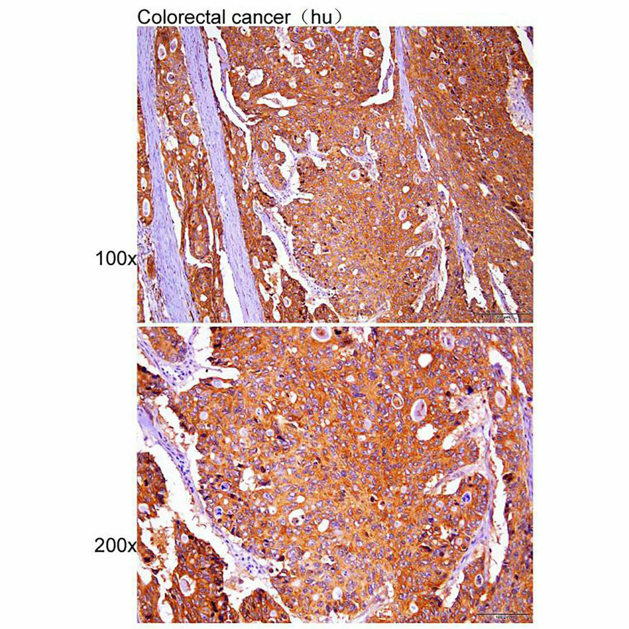 Anti-ATP1A1 Polyclonal Antibody