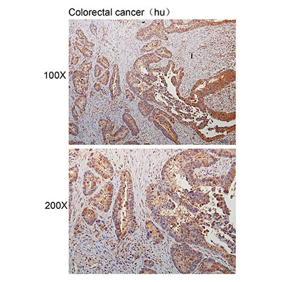 Anti-AAGAB Polyclonal Antibody