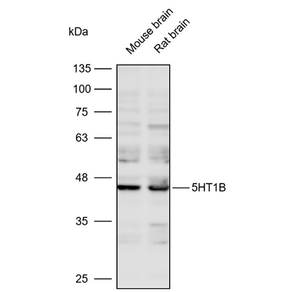 Anti-5HT1B Polyclonal Antibody