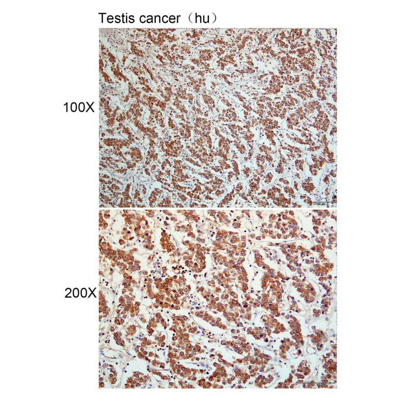 Anti-AAMP Polyclonal Antibody