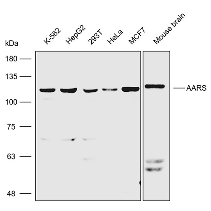 Anti-AARS Polyclonal Antibody