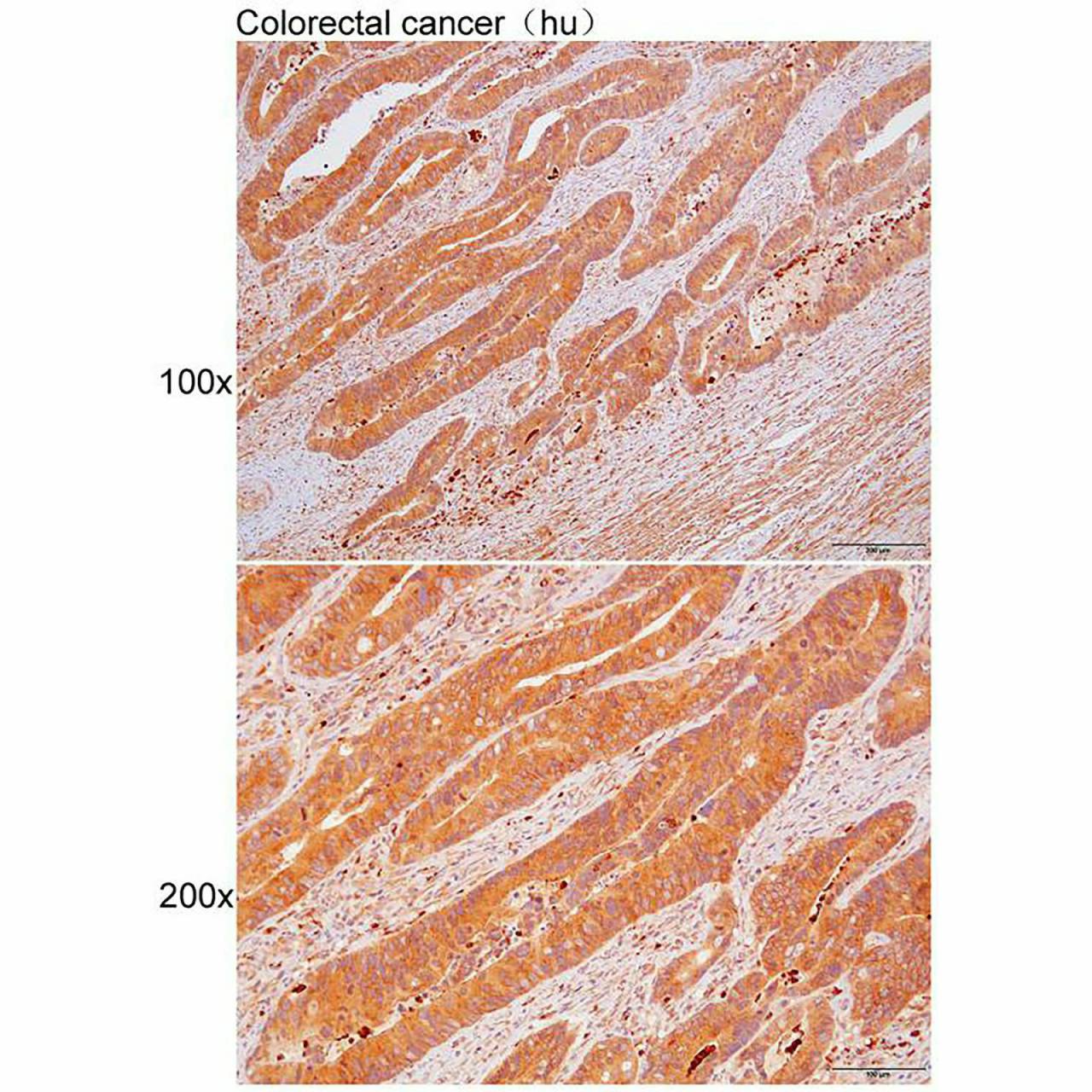 Anti-AARS Polyclonal Antibody Figure 2