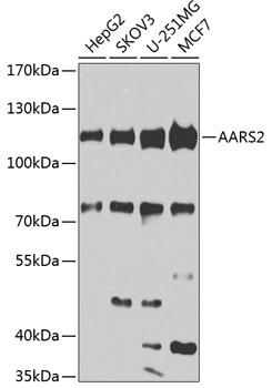 Anti-AARS2 Polyclonal Antibody