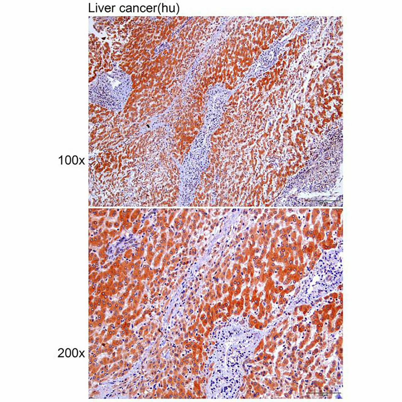 Anti-A2M Polyclonal Antibody