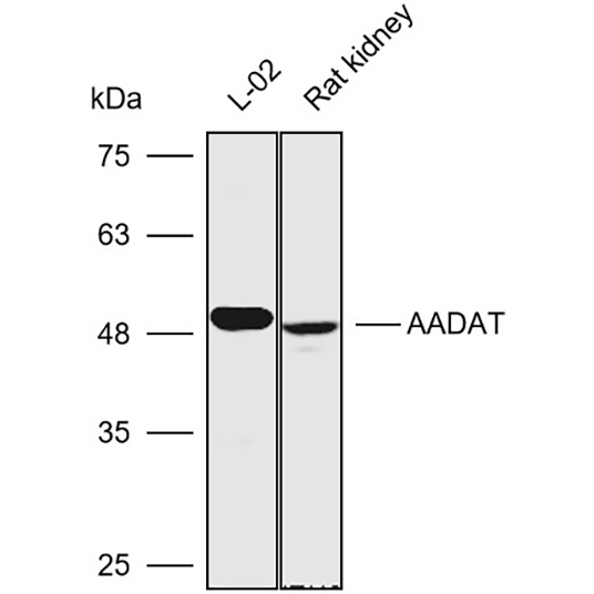 Anti-AADAT Polyclonal Antibody