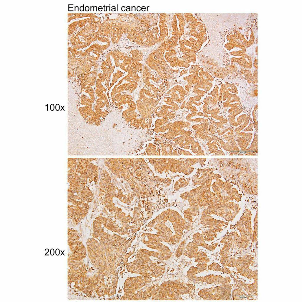 Anti-AADAT Polyclonal Antibody Figure 2