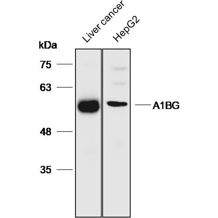 Anti-A1BG Polyclonal Antibody