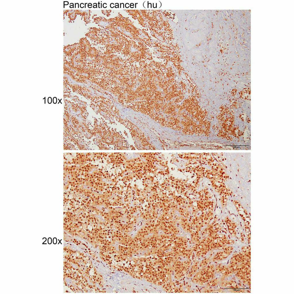 Anti- MOB1B Polyclonal Antibody Figure 2
